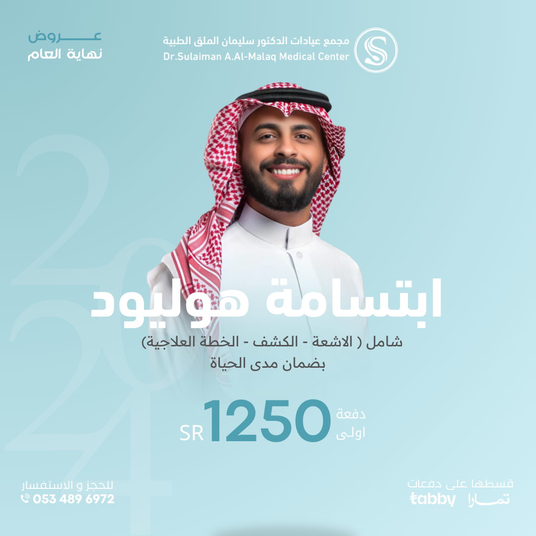 ابتسامة هوليود